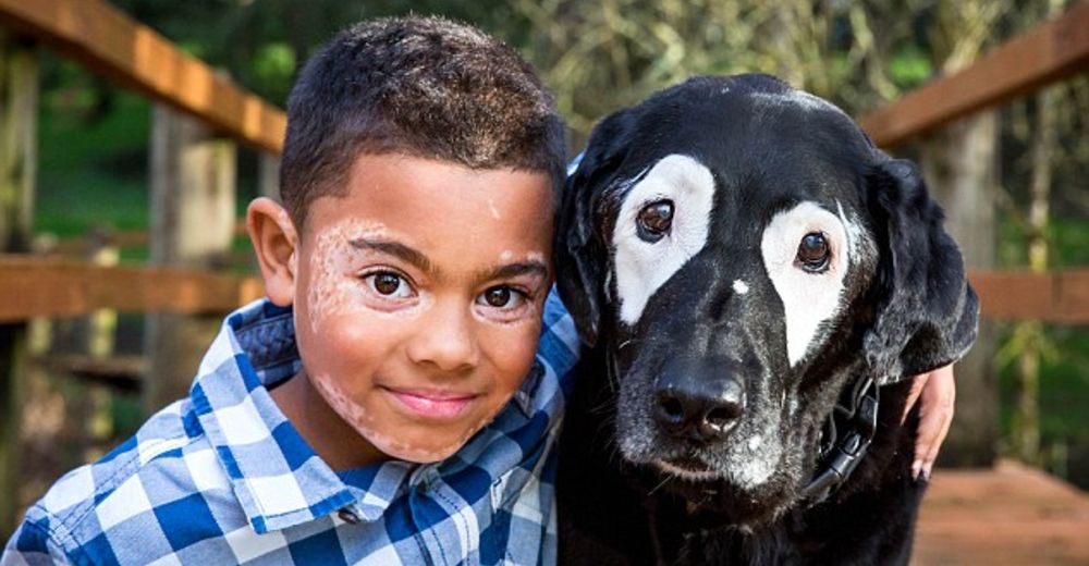 Era muy duro para él enfrentar su condición hasta que conoció un perro que le cambió la vida